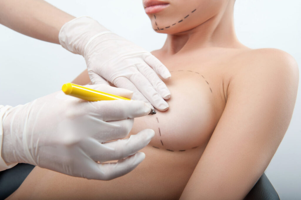 What Is Fat Grafting for Breast Reconstruction?