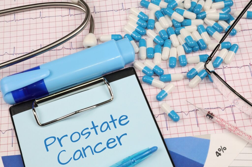 Managing Prostate Cancer with Lifestyle Changes