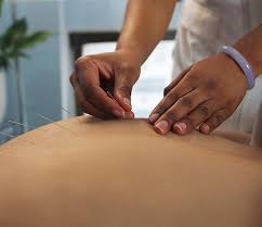 What to Expect During Your First Acupuncture Session